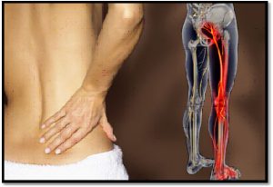 backpain